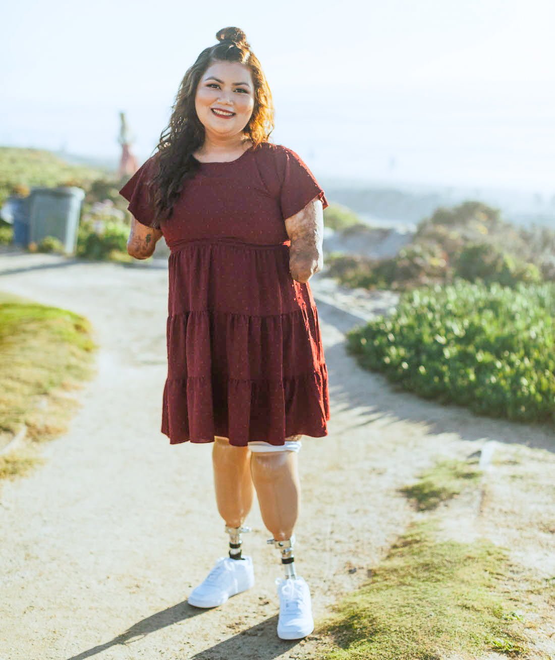 Andrea, Beautifully Flawed Attendee, standing on her prosthetic legs